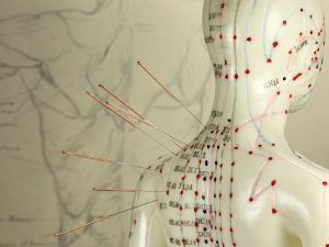 Terapia Holistyczna PAT – Zen Concept – Model Punkty Akupunkturowe i Meridiany Model ludzkiego ciała z zaznaczonymi meridianami i akupunktami oraz igłami akupunkturowymi, nakłuwającymi ramię. Ilustruje Terapię Holistyczną PAT według Medycyny Chińskiej w Zen Concept.